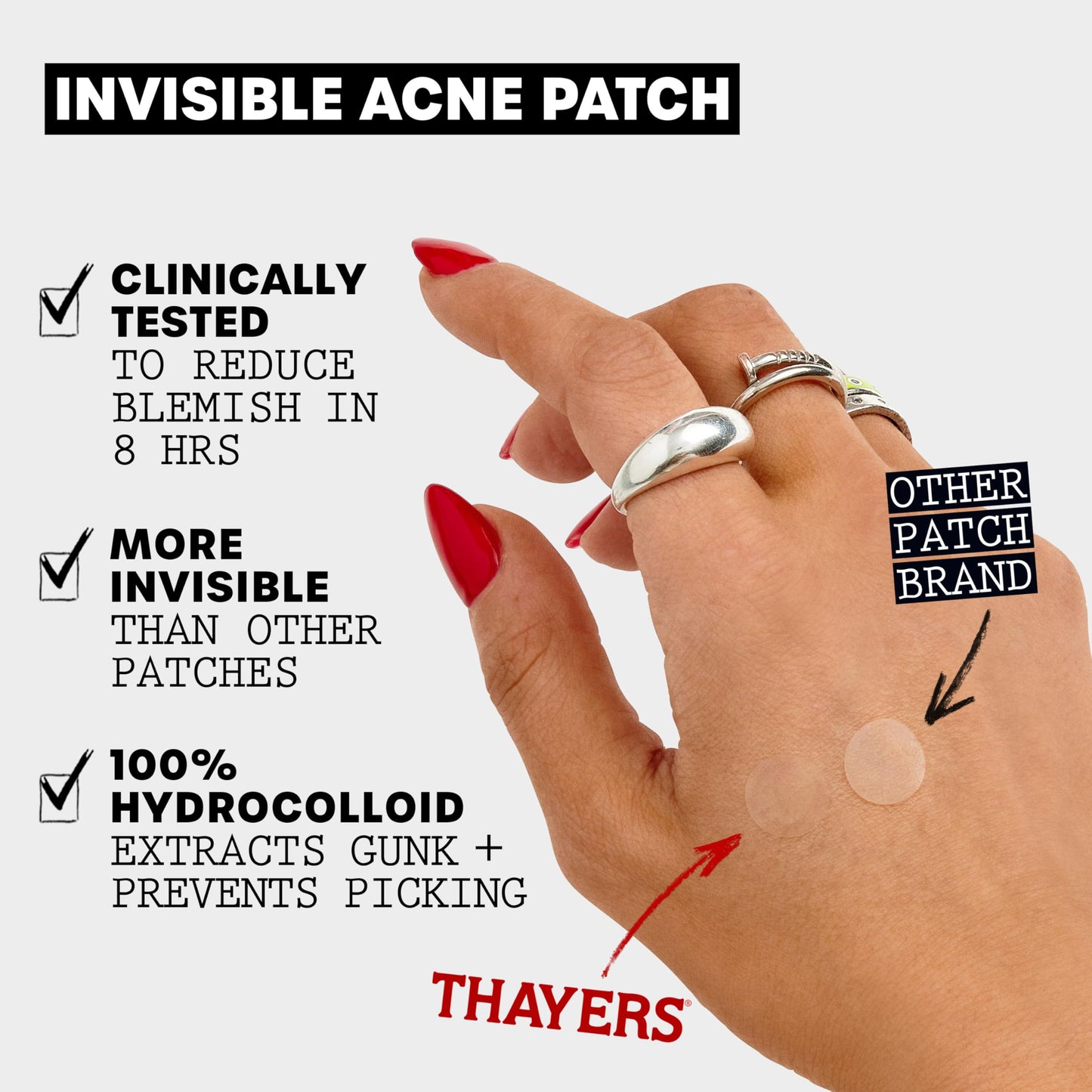 Thayers Blemish Clearing Salicylic Acid Toner, Soothing and Non-Stripping Skin Care,12 Fl Oz + Thayers Invisible S.O.S Hydrocolloid Acne Pimple Patch, Ultra-Thin Design, Set of 22 Pimple Patches