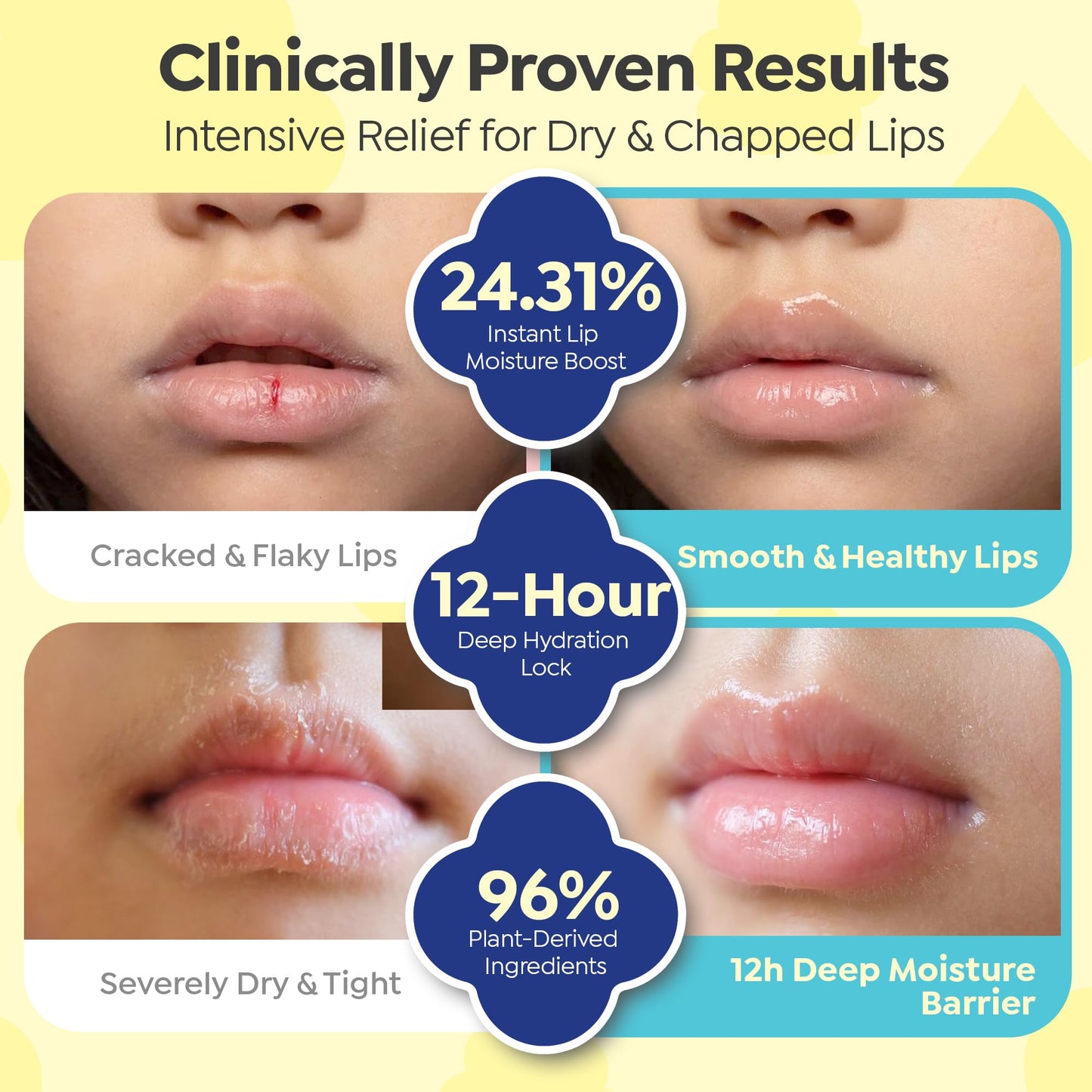 GOONGBE Kids' Moisture Lip Balm - Korean Kids Hydrating Lip Balm for Chapped and Cracked Lips - 12hr Moisturizing Non Oily Lip Care with Plant Oils and Shea Butter - Allergen Free Scent, 0.1 oz.