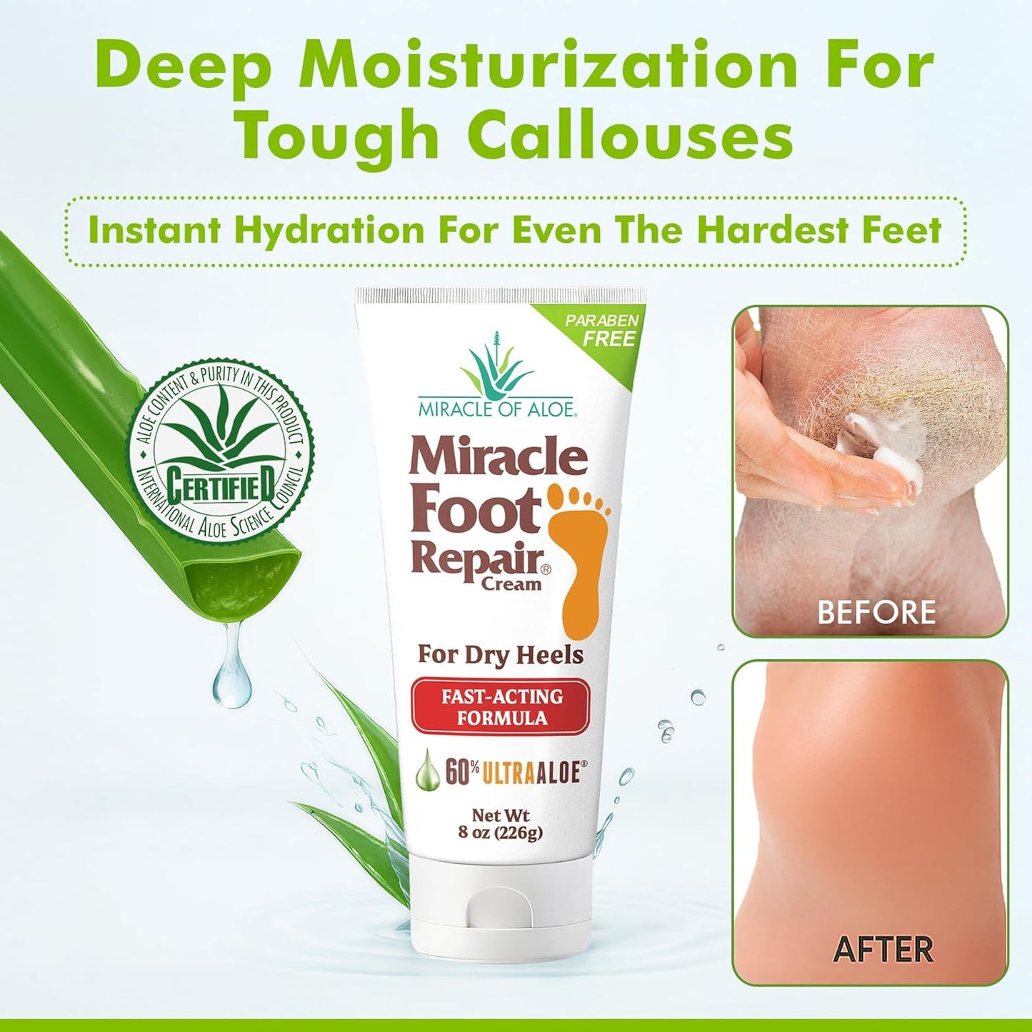 Miracle Foot Repair Cream (1 oz / 12 Pack) Repairs Dry Cracked Heels and Feet, 60% Pure Ultra Aloe Moisturizes, Softens, and Repairs