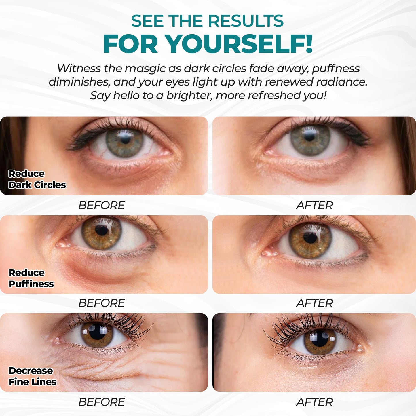 Eye Patches for Reducing Puffy Eyes and Dark Circles (60 patches), Wrinkles (Anti - Wrinkle) | Eye mask patches for Skincare with Retinol, Collagen, Hyaluronic Acid, Green Tea | Anti Wrinkle Patches