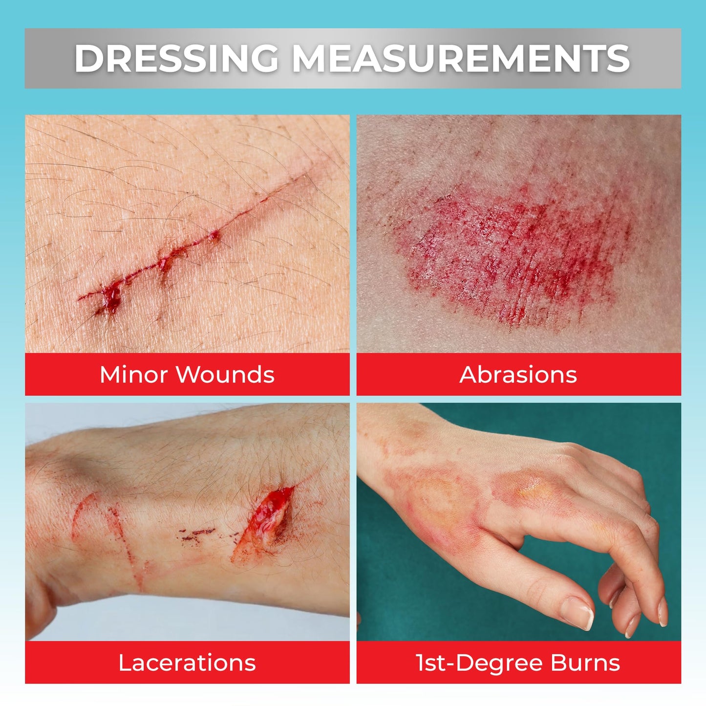 SilverSeal Hydrogel Burn & Wound Dressing Kit with X-Static Silver - FDA Cleared Care for Burns, Cuts & Wounds – Soothing Moisture, Relief & Protection - 4 (2”x3”) Hydrogels + 4 (3”x5”) Adhesive Pads