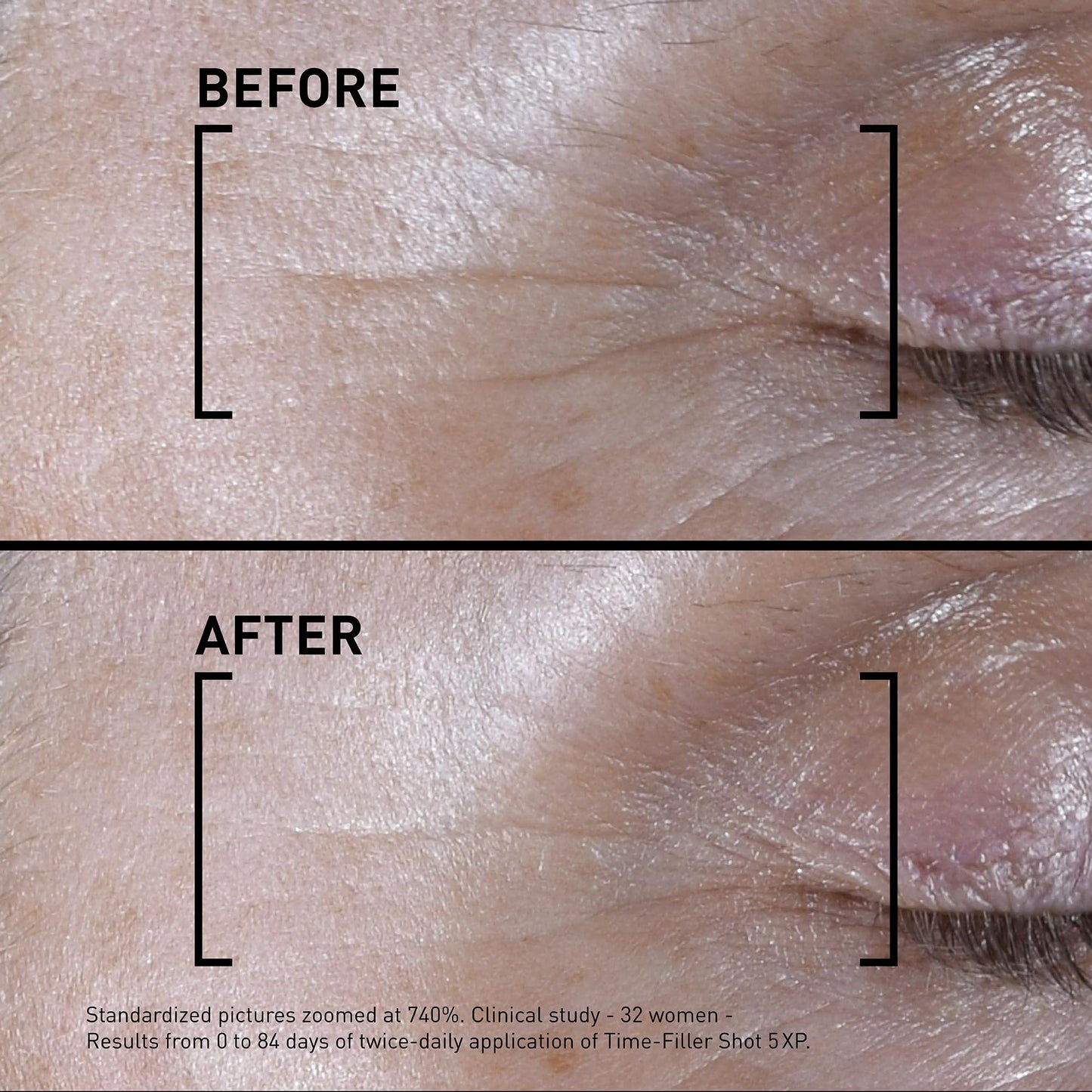 Filorga Time-Filler Shot, A Moisturizing Serum with Neuropeptide Technology & Polysaccharides to Relax Expression Lines, Hydrate, & Firm Skin for Visible Results in 7 Days, 0.5 fl. Oz.
