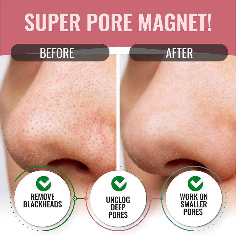 LOOKATME Nose Pore Strips (2-Pack, 10 Nose Strips). Korean Skin Care Blackhead Remover with Aloe Vera. K Beauty Pore Cleaner and Pore Extractor. Acne Mask for Blackhead Removal. Adhesive Pore Mask.