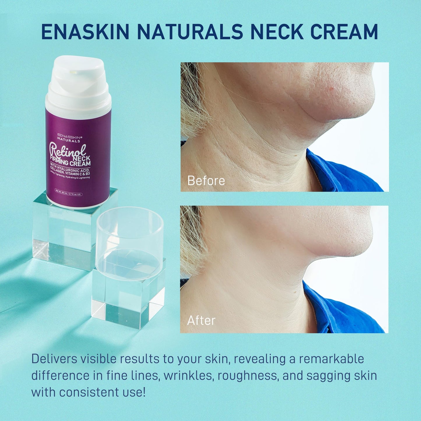 Neck Creams for Tightening and Firming, Retinol Neck Firming Cream with Hyaluronic Acid, Collagen and Vitamin - Tightening Wrinkles, Firming Skin on Face, Neck, Décolleté, Body