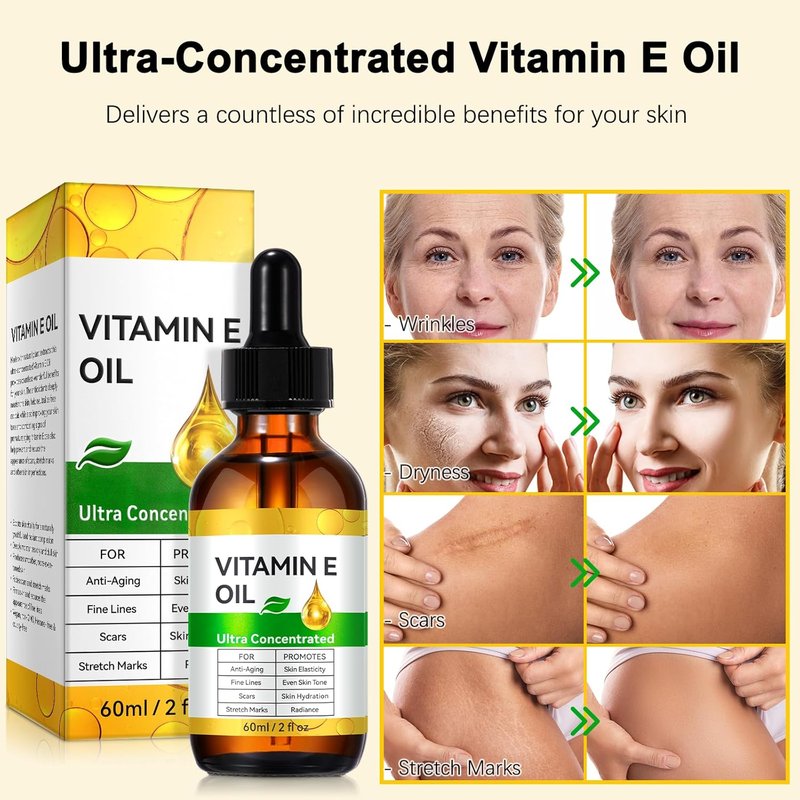 Vitamin E Oil - Pure Skin & Nail Moisturizer for Scars, Hydration, Anti-Aging | 2 Fl Oz (Pack of 2)