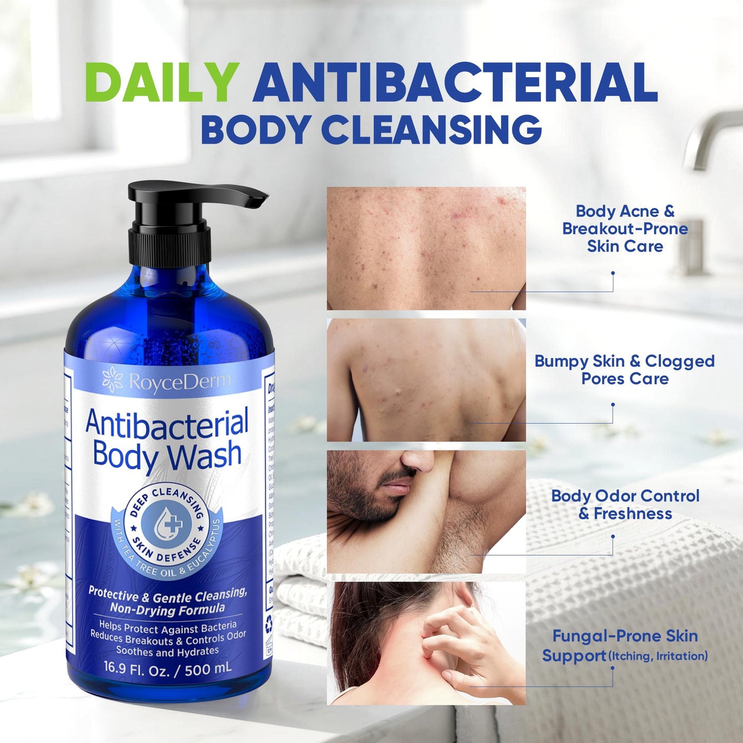 Roycederm Antibacterial & Antifungal Body Wash (16.9 fl oz) - Antibacterial Soap for Odor, Back Acne, Jock Itch, Athlete’s Foot & Eczema - Kills 99.9% of Germs & Bacteria - Non-Drying Daily Cleanse
