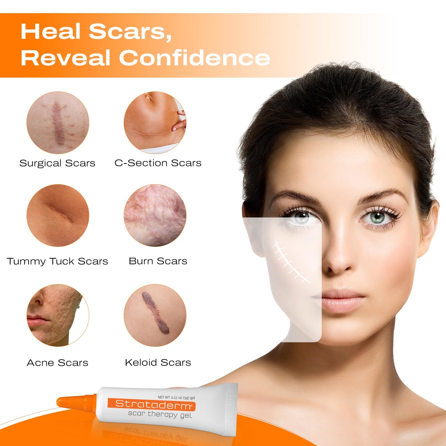 Strataderm Professional Scar Therapy Gel | Old and New Scars from General Surgery, Trauma, Wounds, Burns, Bites, Acne & Skin Disease | Reduces Redness, Discoloration, Discomfort & Itch | 5g (0.17oz)