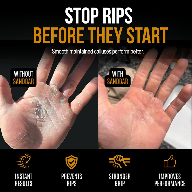 SandBar Callus Remover File for Hands - Durable Aluminum Tool for Callus Care and Dead Skin Removal - Includes Nourishing Salve - Ideal for Athletes, Climbers, and Gym Enthusiasts