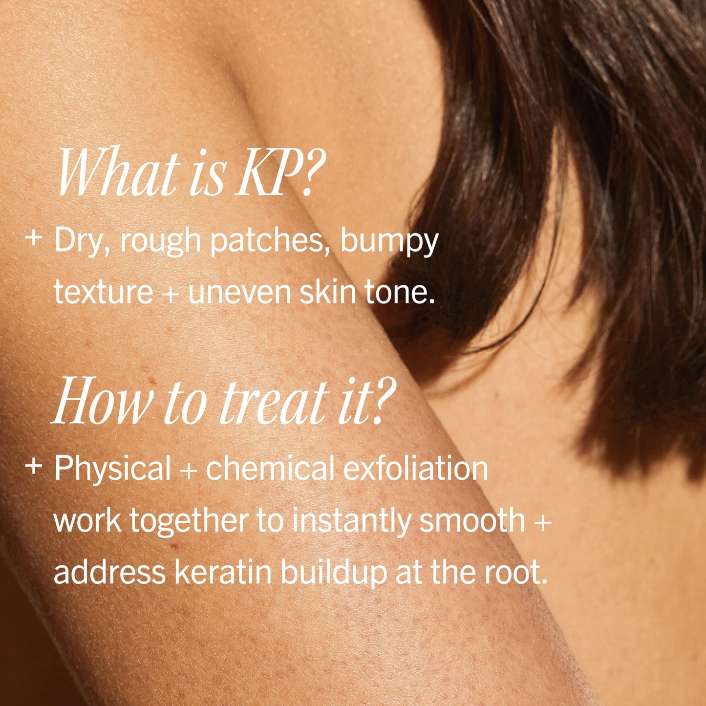First Aid Beauty KP Bump Eraser Body Scrub with 10% AHA - Dermatologist-Tested Keratosis Pilaris Exfoliator - Support for Rough Bumps & Uneven Skin Texture - Sensitive Skin - 8 oz, Fresh Peach