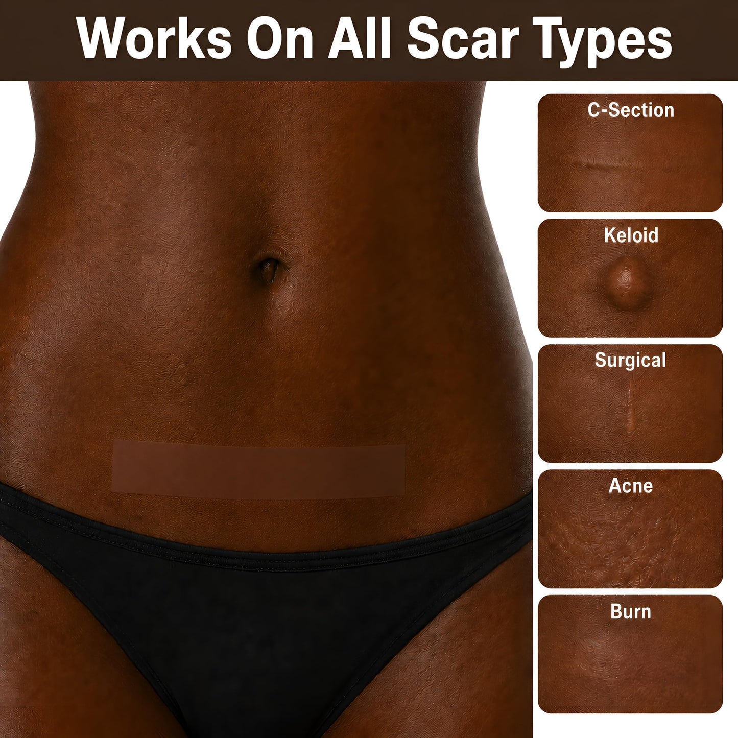 Nugexa Silicone Scar Tape & Sheets – All Skin Tones, Medical Grade