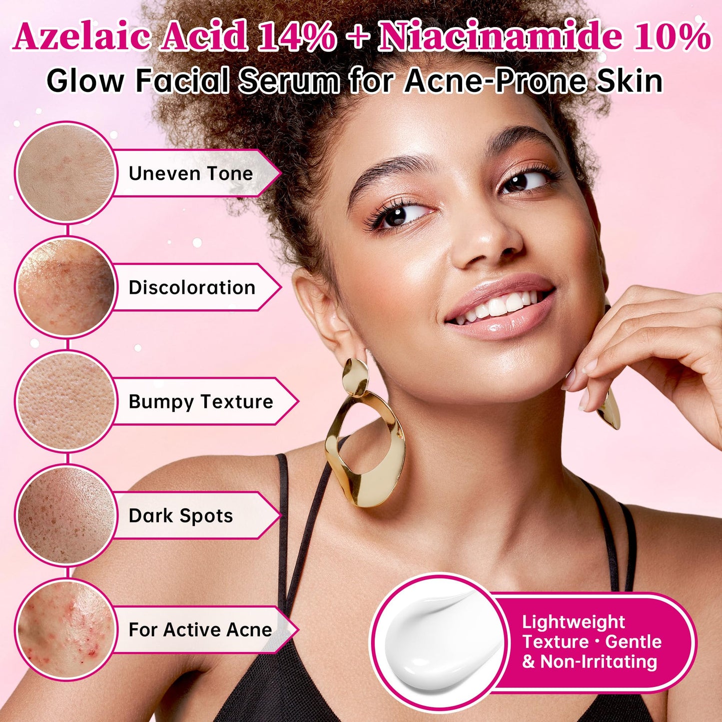 14% Azelaic Acid Acne Cream with Niacinamide & Centella,Azelaic Acid Facial Serum–Smooth & Even Skin Tone,Reduce the Appearance of Blemishes,Dark Spots&Uneven Skin,Gentle Hydrating Formula,1.4oz,2PCS