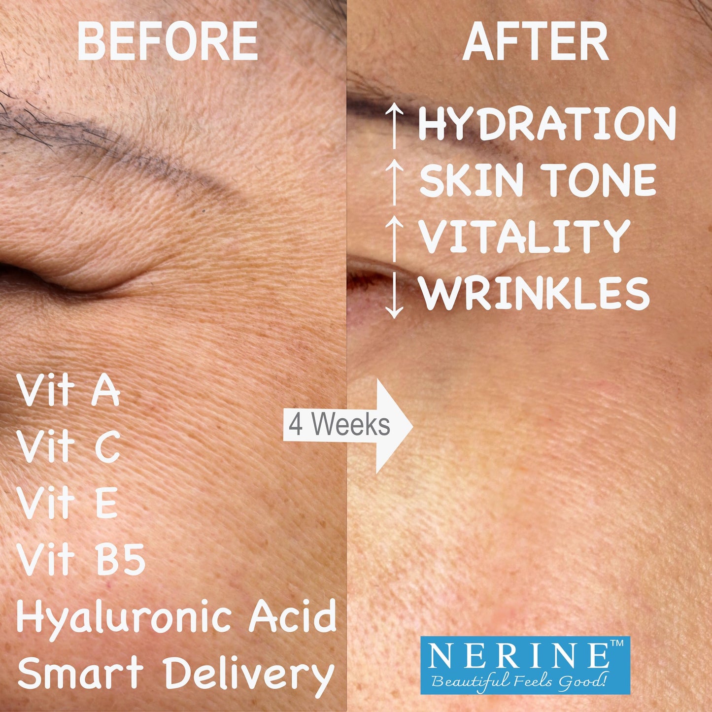 Anti Aging Moisturizer Cream for Face and Neck Tightening | Hyaluronic Acid plus Vitamin C and Vitamin A | Proven Anti Wrinkle Repair Complex | Neck and Face Lift Moisturiser Cream