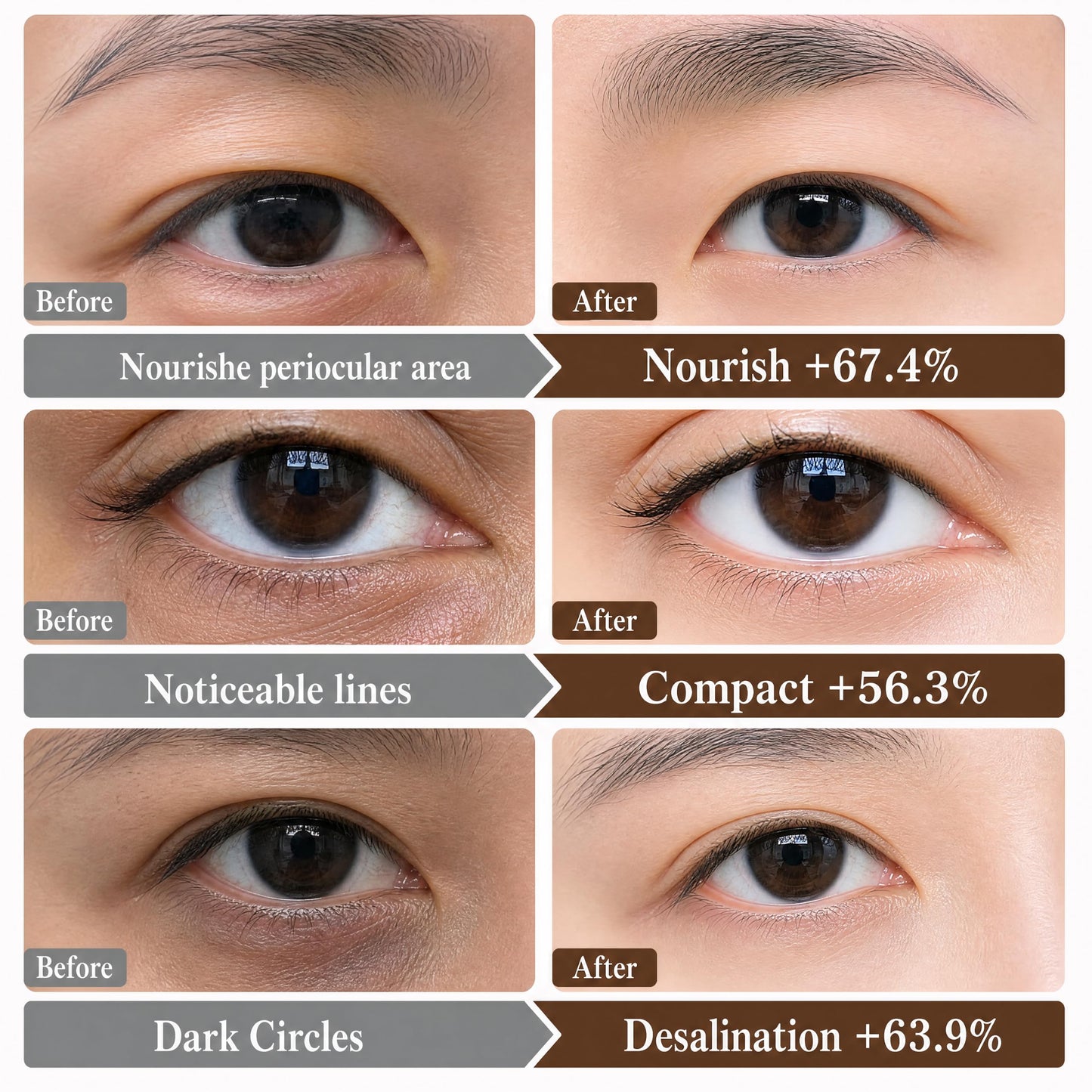 Novoy 15 Pairs Bio-Collagen Real Deep Eye Patches - 6-in-1 Retinol Overnight Eye Patches for Dark Circles, Puffiness & Wrinkles | 2% Caffeine+Hyaluronic+Niacinamide, Korean Popular Eye Mask - ROSE