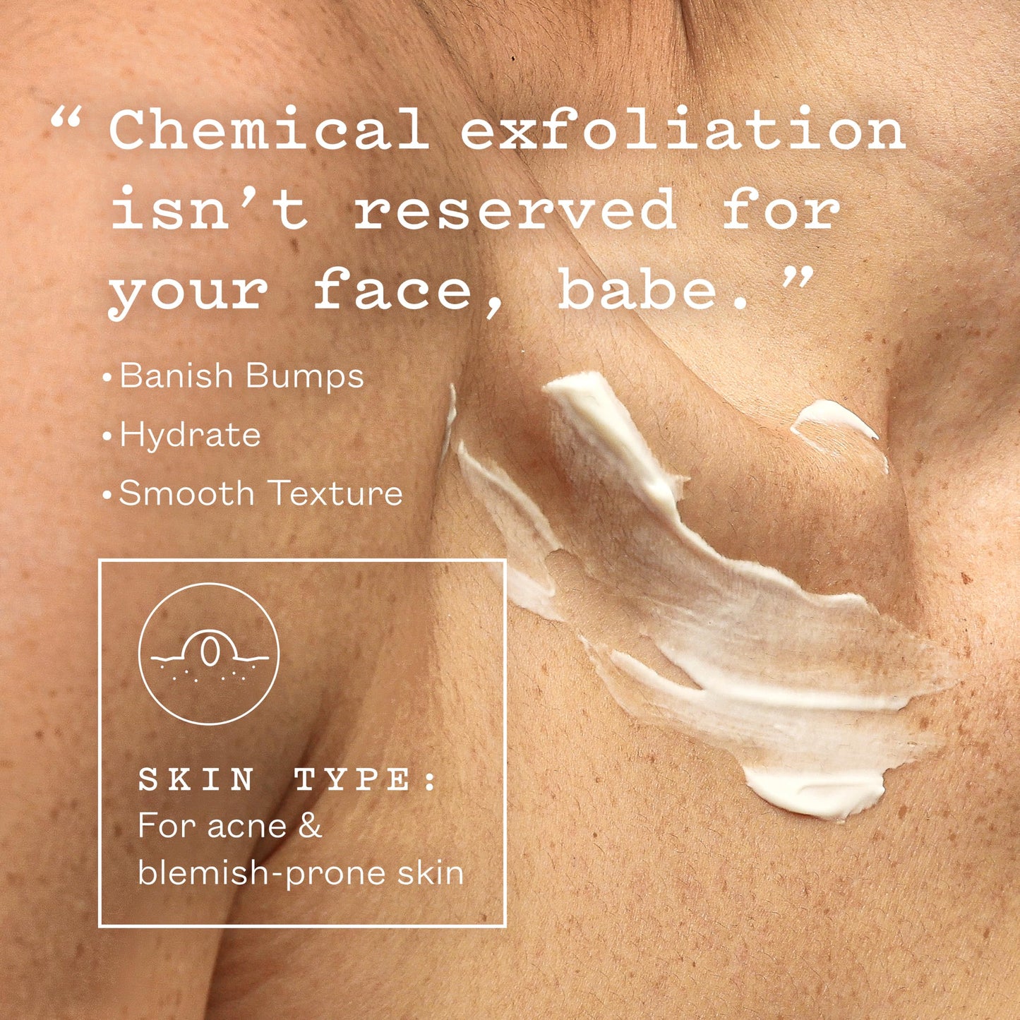 frank body Smoothing AHA Body Lotion | Gently Exfoliates to Smooth KP & Body Breakouts | With Lactic & Glycolic Acids, Hydrating Oils, Mango Seed Butter & Australian Botanicals | 140ml/4.73 fl oz
