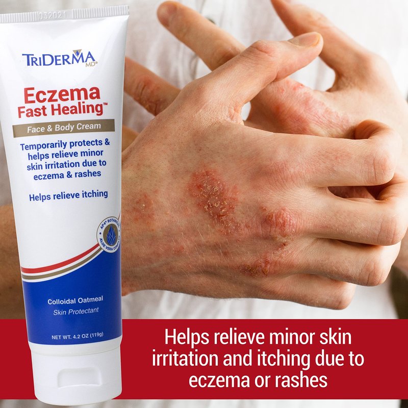 TriDerma Fast Healing Eczema Cream for Adults, FSA Eligible, Colloidal Oats, AP4 Aloe Vera Gel, Vitamins, Eczema Relief Cream for Face & Body Itchy Skin & Rashes, No Cortisone or Fragrance - 4.2oz